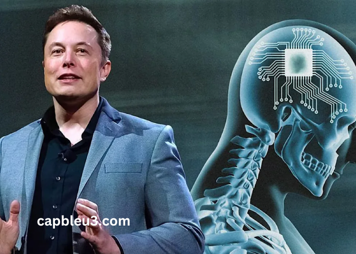 rajkotupdates.news Elon Musk in 2022 Neuralink Start to Implantation of Brain Chips in Humans